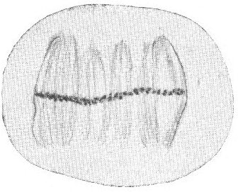 Amoeba proteus: Ausrichtung der Spindelfasern in der Metaphase. Quelle: Franz Doflein: Lehrbuch der Protozoenkunde.