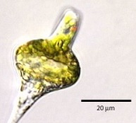 Euglena mit bauchig verformtem Zellleib